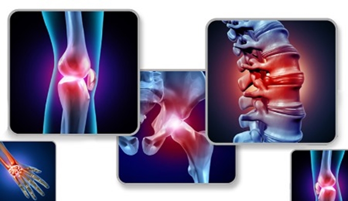 کلینیک سلامت اسکلتی عضلانی با هدف پیشگیری از پوکی استخوان و درمان آرتروز زانو